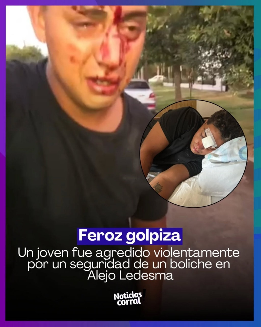 JOVEN RECIBIÓ FEROZ GOLPIZA EN ALEJO LEDESMA