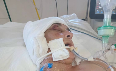 ARIAS: MUJER BRUTALMENTE GOLPEADA